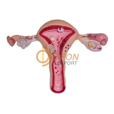 Uterus Model