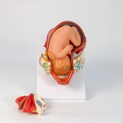 Delivery Birth Set Model