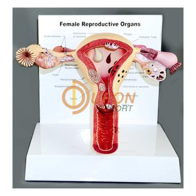 Model of Ovary Model