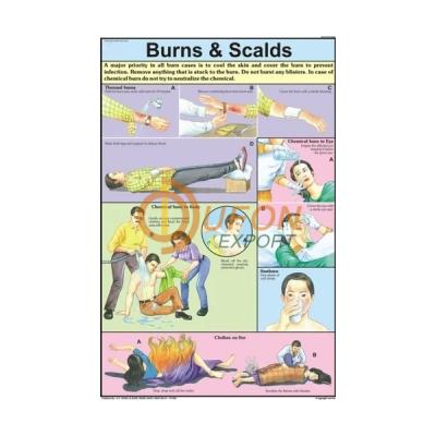 Burns and Scalds Chart