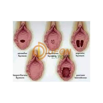 Hymen Cribriform Model