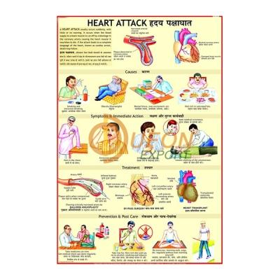 Heart Attack Chart