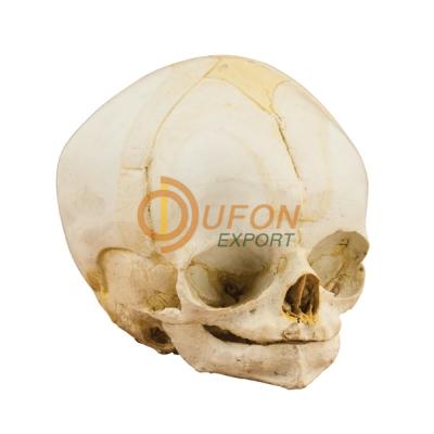 Human Fetal Skull