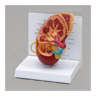 Kidney Model