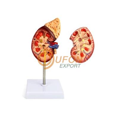 Life Size Kidney Model