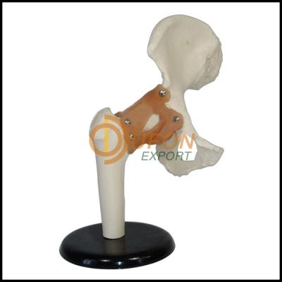 Hip Implants Model