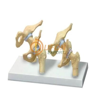 Hip Osteoarthritis Model