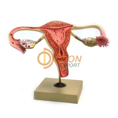 Ovary Model