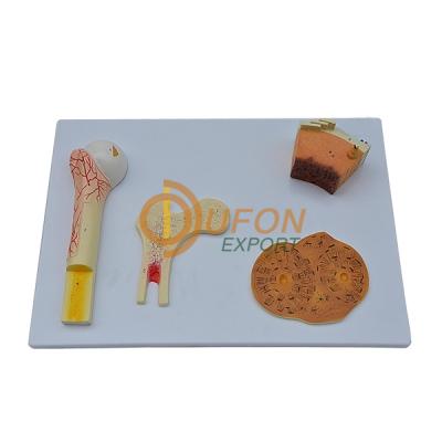 Bone Tissue Model
