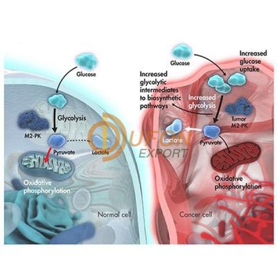 Lung Abscess Complicated by Fungus Ball Model