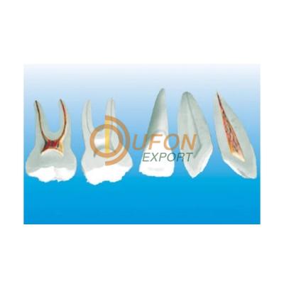 Expansion Model of Human Teeth