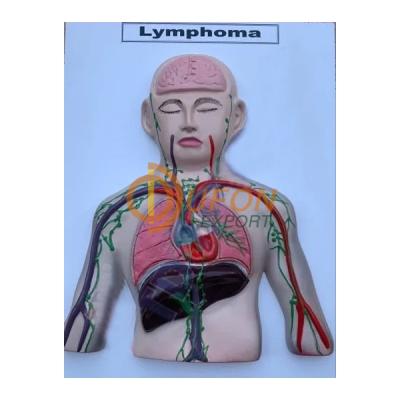 Lymphoma Model