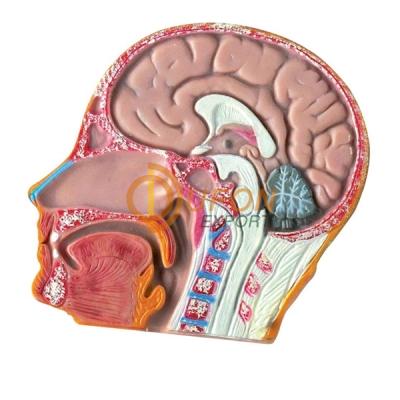 Meningioma Model