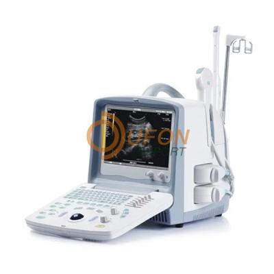 Digital Ultrasound Diagnostic Device