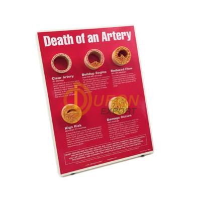 Death of an Artery Models