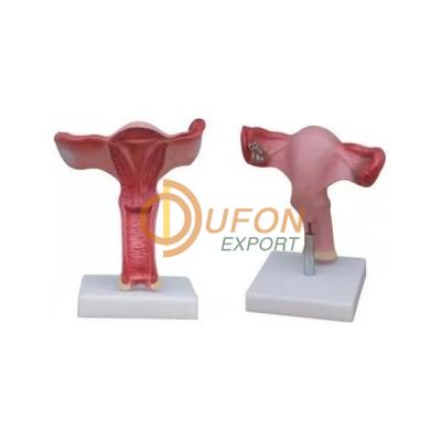 Magnified Uterus Model