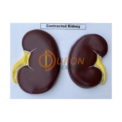 Contracted Kidney Model