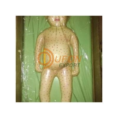 Child with Chiken Pox and Small Pox Model