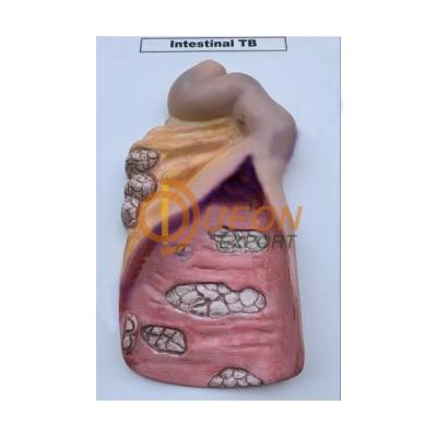 Intestinal T.B. Model