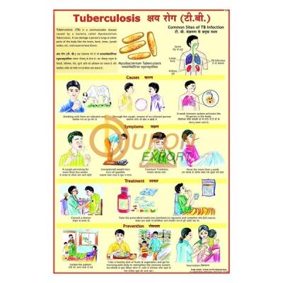 Tuberculosis Chart