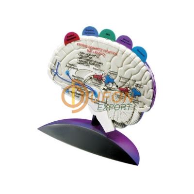 Brain Model with Tabbed Overlays