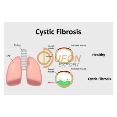 Cystic Fibrosis Model