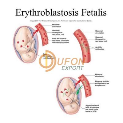 Erythroblastosis Fetalis Model