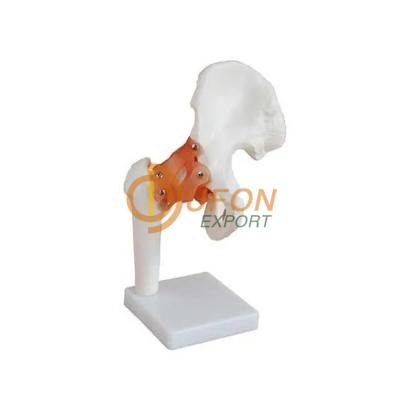 Hip Joint Model