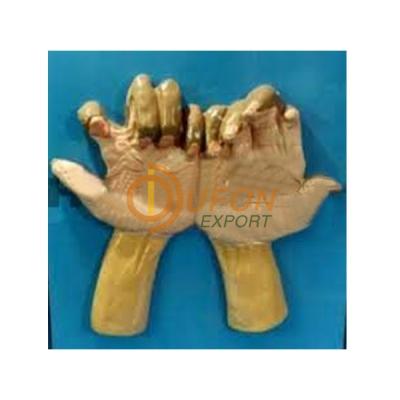 Claw Hands in Leprosy Model