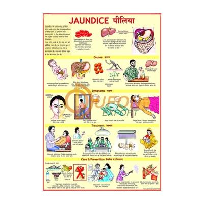 Jaundice Chart