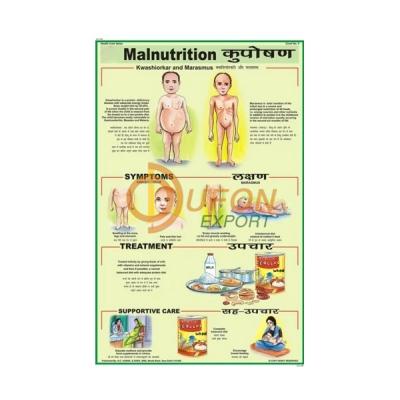 Malnutrition Chart