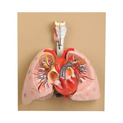 Heart with Lungs and Larynx